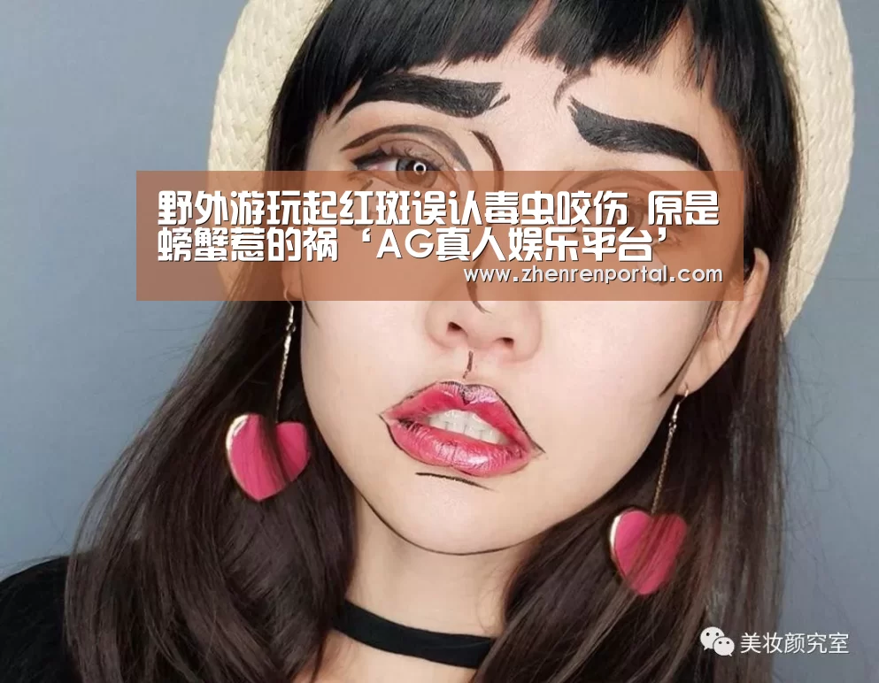 野外游玩起红斑误认毒虫咬伤 原是螃蟹惹的祸‘AG真人娱乐平台’(图1) AG亚游真人平台